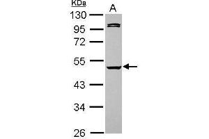 WB Image Sample (30 ug of whole cell lysate) A: HeLa 10% SDS PAGE antibody diluted at 1:5000 (Caspase 1 抗体)