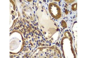 Immunohistochemistry of paraffin-embedded Human kidney using NME2 Polyclonal Antibody at dilution of 1:100 (40x lens). (NME2 抗体)