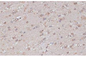 Immunohistochemistry of paraffin-embedded Mouse brain using TLK1 Polyclonal Antibody at dilution of 1:100 (40x lens). (TLK1 抗体)