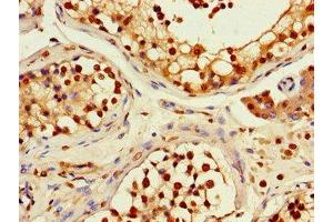 Immunohistochemistry of paraffin-embedded human testis tissue using ABIN7167735 at dilution of 1:100 (RFPL4B 抗体  (AA 1-263))