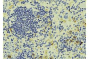 Immunohistochemistry (IHC) image for anti-Protein Tyrosine Phosphatase Type IVA, Member 1 (PTP4A1) (C-Term) antibody (ABIN6264513)