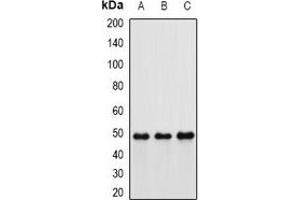 Western blot analysis of Hippi expression in MCF7 (A), mouse kidney (B), rat lung (C) whole cell lysates. (IFT57 抗体)