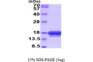SDS-PAGE (SDS) image for Interleukin 5 (IL5) (AA 20-134) (Active) protein (His tag) (ABIN5777626)