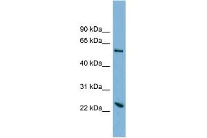 WB Suggested Anti-TMEM161A Antibody Titration:  0. (TMEM161A 抗体  (Middle Region))