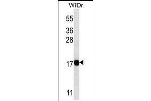 Western blot analysis in WiDr cell line lysates (35ug/lane). (PAEP 抗体  (AA 73-101))