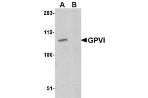 Image no. 1 for anti-Glycoprotein VI (Platelet) (GP6) (C-Term) antibody (ABIN342705) (GP6 抗体  (C-Term))