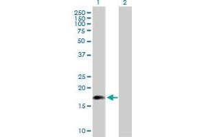 Western Blot analysis of ARL5A expression in transfected 293T cell line by ARL5A MaxPab polyclonal antibody. (ARL5A 抗体  (AA 1-179))