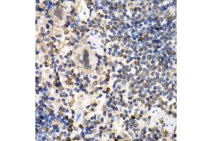 Immunohistochemistry of paraffin-embedded mouse spleen using RAD1 antibody (ABIN5995531) at dilution of 1/200 (40x lens). (RAD1 抗体)