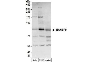 Western Blotting (WB) image for anti-Importin 9 (IPO9) (AA 125-175) antibody (ABIN7450635)