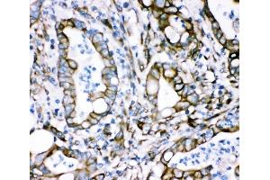 IHC analysis of Plectin using anti-Plectin antibody (ABIN3043900).