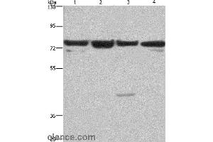 Western blot analysis of HUVEC, NIH/3T3, Hela and 293T cell, using KLF11 Polyclonal Antibody at dilution of 1:350 (KLF11 抗体)