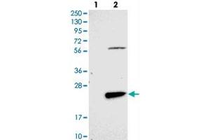 Western blot analysis of Lane 1: Negative control (vector only transfected HEK293T lysate), Lane 2: Over-expression Lysate (Co-expressed with a C-terminal myc-DDK tag (~3. (FAM167B 抗体)