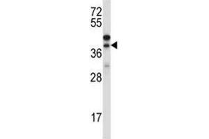 Western blot testing of CTGF antibody and NCI-H460 lysate (CTGF 抗体  (AA 166-193))