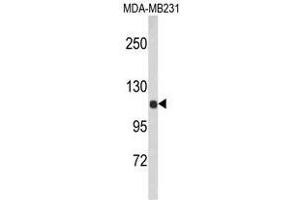 Image no. 1 for anti-Actinin, alpha 1 (ACTN1) (N-Term) antibody (ABIN452717) (ACTN1 抗体  (N-Term))