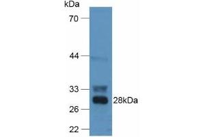 Detection of F12 in Mouse Liver Tissue using Polyclonal Antibody to Coagulation Factor XII (F12) (F12 抗体  (AA 352-587))
