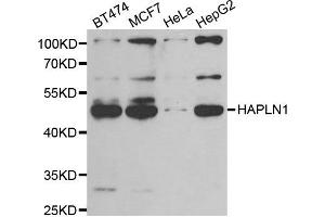 Western blot analysis of extracts of various cell lines, using HAPLN1 antibody.