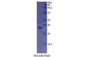 SDS-PAGE analysis of Cow MHCDRa Protein. (HLA-DRA 蛋白)