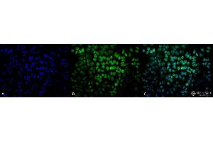 Immunocytochemistry/Immunofluorescence analysis using Rabbit Anti-TNF-R1 Polyclonal Antibody . (TNFRSF1A 抗体  (AA 20-43) (FITC))