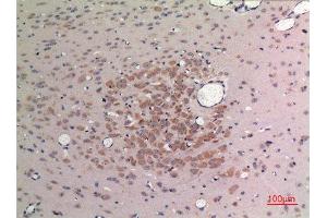 Immunohistochemistry (IHC) analysis of paraffin-embedded Rat Brain, antibody was diluted at 1:100. (FGF9 抗体  (C-Term))