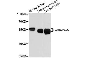 Western blot analysis of extracts of various cell lines, using CRISPLD2 antibody (ABIN6291926) at 1:3000 dilution.