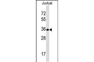 Western blot analysis in Jurkat cell line lysates (35ug/lane). (Uroplakin 3B 抗体  (AA 192-219))