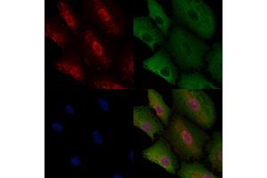 ABIN6258131 and ABIN6275518 staining  cells by IF/ICC.