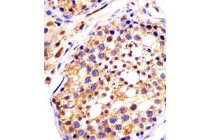 Immunohistochemistry (Paraffin-embedded Sections) (IHC (p)) image for anti-Dynein, Cytoplasmic 1, Heavy Chain 1 (DYNC1H1) (AA 4202-4236), (C-Term) antibody (ABIN6242987)