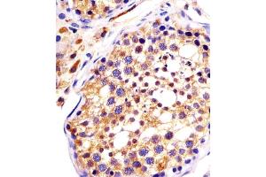 (ABIN6242987 and ABIN6578147) staining DYNC1H1 in human testis sections by Immunohistochemistry (IHC-P - paraformaldehyde-fixed, paraffin-embedded sections). (DYNC1H1 抗体  (C-Term))