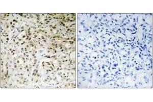 Immunohistochemistry (IHC) image for anti-TAF5 RNA Polymerase II, TATA Box Binding Protein (TBP)-Associated Factor, 100kDa (TAF5) (AA 381-430) antibody (ABIN1533911)