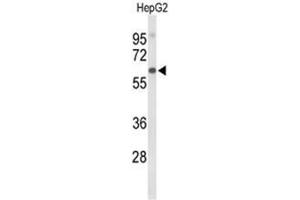 Western blot analysis of AFM Antibody (N-term) in HepG2 cell line lysates (35µg/lane). (Afamin 抗体  (N-Term))
