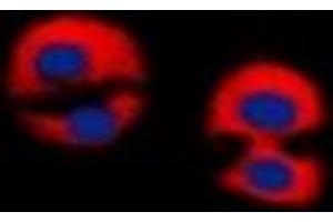 Immunofluorescent analysis of Dematin staining in Jurkat cells. (Dematin 抗体  (C-Term))