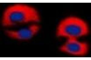 Immunofluorescent analysis of Dematin staining in Jurkat cells.