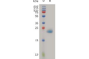 SDS-PAGE (SDS) image for Peptidoglycan Recognition Protein 1 (PGLYRP1) (AA 22-196) protein (His tag) (ABIN7491101)