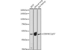 Western blot analysis of extracts of various cell lines, using CDKN1C/p57 Kip2 antibody (ABIN3022818, ABIN3022819, ABIN3022820, ABIN1512749 and ABIN6219243) at 1:1000 dilution. (CDKN1C 抗体  (AA 1-100))