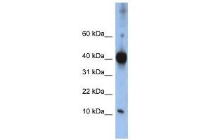 LSM4 antibody used at 1 ug/ml to detect target protein. (LSM4 抗体)
