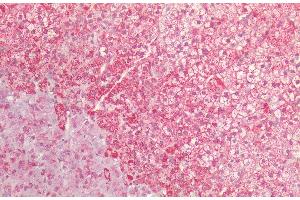 Immunohistochemistry analysis using Rabbit Anti-HSP60 Polyclonal Antibody (ABIN2486158). (HSPD1 抗体  (Biotin))