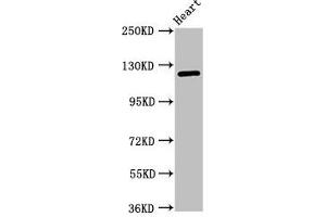 Western Blot Positive WB detected in: Mouse heart tissue All lanes: SEMA5B antibody at 1 μg/mL Secondary Goat polyclonal to rabbit IgG at 1/50000 dilution Predicted band size: 126, 120, 124, 132 kDa Observed band size: 126 kDa (SEMA5B 抗体  (AA 845-1013))