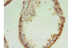 Immunohistochemistry of paraffin-embedded human testis tissue using ABIN7159148 at dilution of 1:100 (MED28 抗体  (AA 1-178))