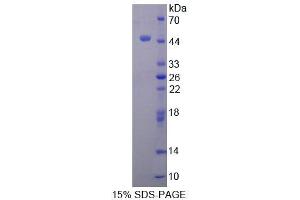 SDS-PAGE analysis of Human TTF1 Protein. (TTF1 蛋白)