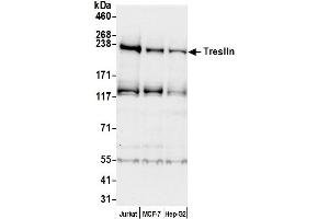 anti-Treslin (AA 975-1025) antibody