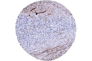 Cerebellum molecular layer Purkinje cell layer granule cell layer white matter A strong Calbindin 1 staining of Purkinje cells and of associated axonal fibres is seen in the cerebrum (CALB1 抗体  (AA 7-96))
