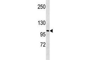 LOXL2 antibody western blot analysis in A549 lysate. (LOXL2 抗体  (AA 589-617))