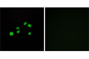 Immunofluorescence analysis of HepG2 cells, using Collagen XXIII α1 antibody. (COL23A1 抗体)
