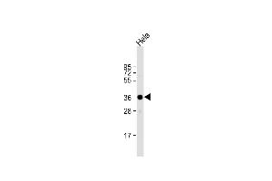 Anti-ARPC1A Antibody (C-term) at 1:1000 dilution + Hela whole cell lysate Lysates/proteins at 20 μg per lane.