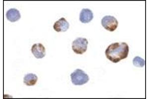 Immunocytochemistry of PAK5 in K562 cells with this product at 2 μg/ml. (PAK7 抗体  (Center))