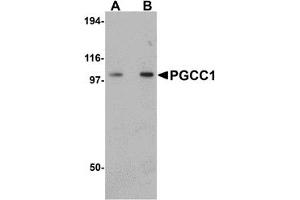 Western Blotting (WB) image for anti-Family with Sequence Similarity 120B (FAM120B) (C-Term) antibody (ABIN1030576) (FAM120B 抗体  (C-Term))