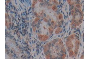 Used in DAB staining on fromalin fixed paraffin- embedded liver tissue (Thrombospondin 1 抗体  (AA 24-221))