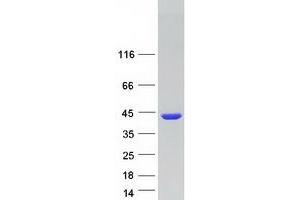 Western Blotting (WB) image for Aldo-Keto Reductase Family 1, Member C3 (3-alpha Hydroxysteroid Dehydrogenase, Type II) (AKR1C3) protein (Myc-DYKDDDDK Tag) (ABIN2714505)