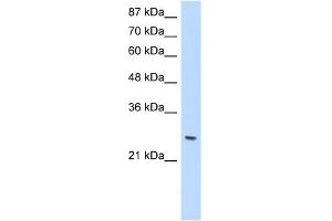 WB Suggested Anti-ZNF575 Antibody Titration:  1. (ZNF575 抗体  (C-Term))