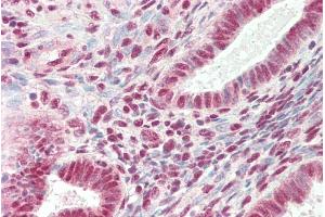 ABIN2613482 (5µg/ml) staining of paraffin embedded Human Uterus. (SRRT 抗体  (C-Term))